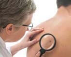 Dermatólogo Clinica Medica La Marina