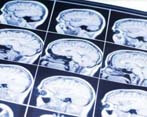 Radiólogo Clinica Radiologica Torrent